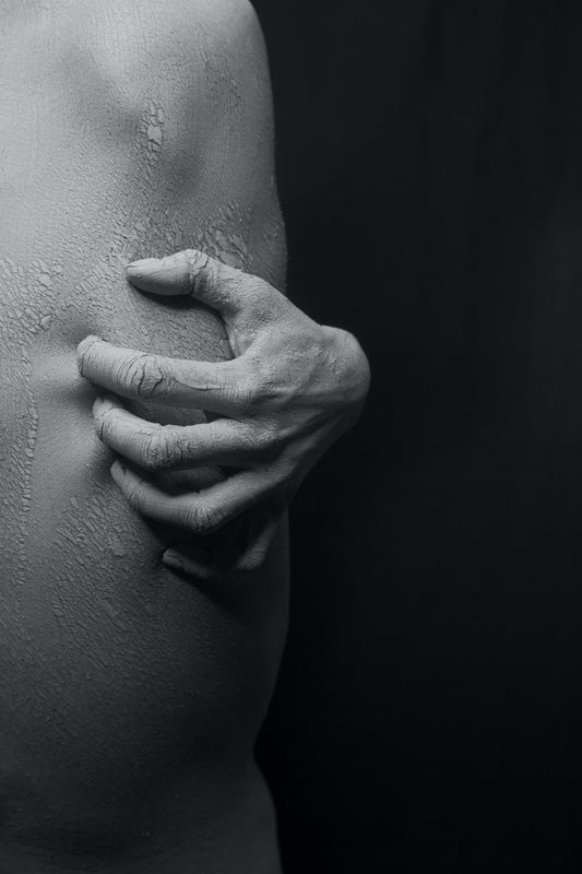 Eczema in Black Skin | What skin type does it affect the most?
